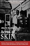 Acres of Skin by Allen M. Hornblum Acres of Skin by Allen M. Hornblum