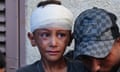 An injured child cries in the yard of the Al-Aqsa Martyrs hospital.