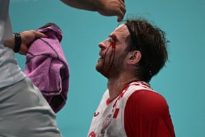 Veron Nacinovic receives medical attention after sustaining an injury during the men’s handball match between Croatia and Germany