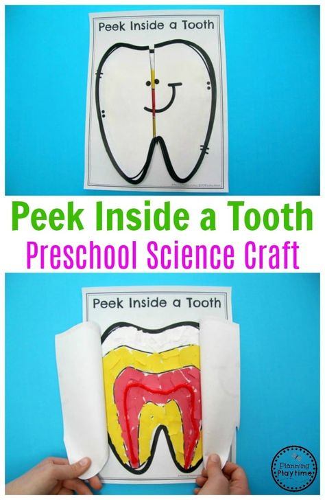 Dentist Circle Time Activities, Parts Of The Tooth Preschool, Parts Of A Tooth Preschool, Preschool Science Crafts, Preschool Dental Health, Tooth Craft, Tooth Preschool, Dental Activities, Dental Health Preschool Crafts