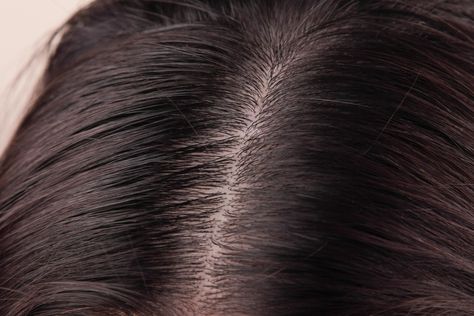 How to Clean Sebum From the Scalp Natural Hair Removal Remedies, Remove Body Hair Permanently, Clean Scalp, Thick Hair Remedies, Coconut Oil Hair Mask, Oily Scalp, Scalp Health, Hair Control, Coconut Oil Hair