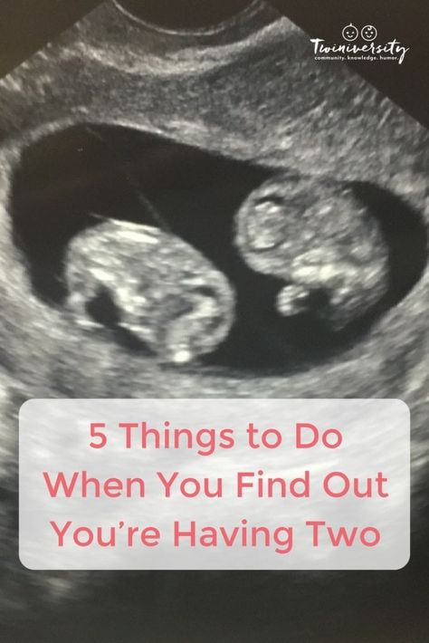 5 Things to Do When You Find Out You’re Having Two Twins Ultrasound, Twin Pregnancy Belly, Twin Baby Announcements, Twins Announcement, Breastfeeding Twins, Twin Pregnancy Announcement, Raising Twins, Twin Life, Expecting Twins