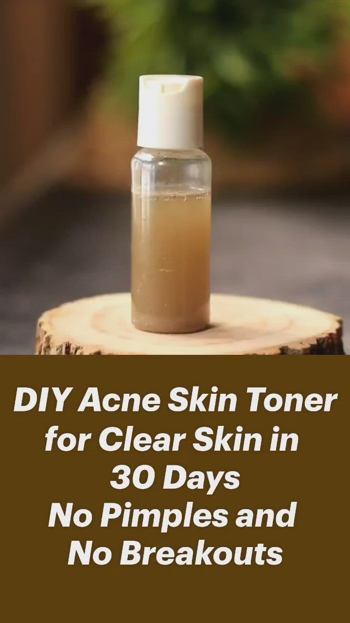 This contains an image of: DIY Acne Skin Toner for Clear Skin in  30 Days No Pimples and  No Breakouts