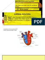 Lesson 22 ECG Traces