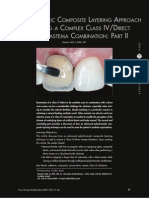 Class IV Restorations Polychromatic