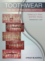 Toothwear: The ABC of the Worn Dentition