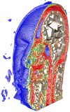 Interval volume of Visible Human head.