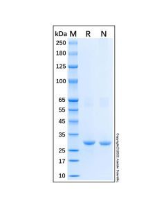 Recombinant Human Fatty Acid Synthase Protein - , expressed in , from , , used for , CAS No.