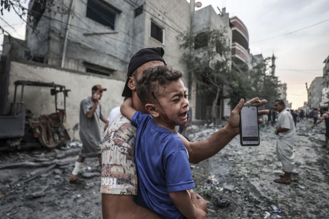 An injured Palestinian child is pictured in the aftermath of Israeli airstrikes at al-Shati refugee camp in Gaza on October 9. 