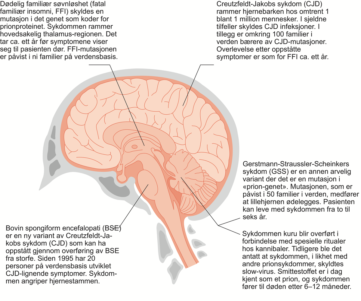 Prionsykdommer.