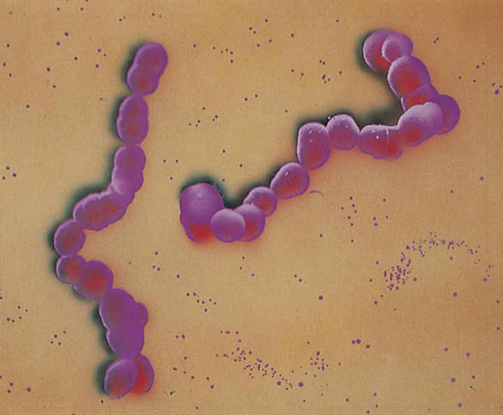Bakterier (Anatomi og morfologi) (streptokokker)