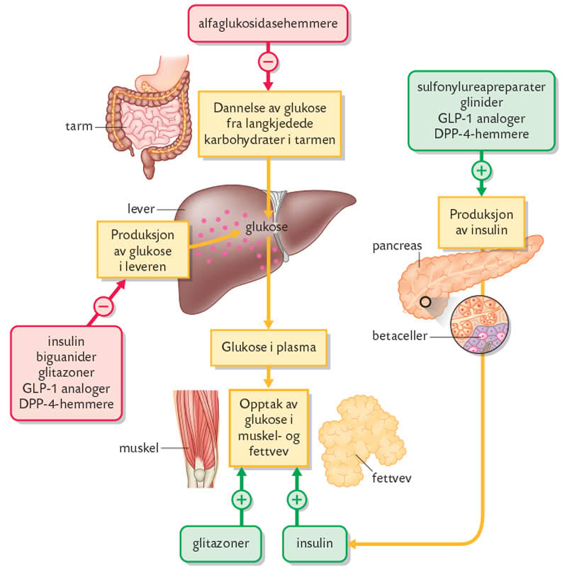 Diabetes type 2 behandling