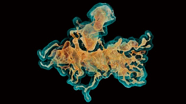 Whole-mount 3D confocal image of a human colonic organoid immunolabeled for F-actin (red–yellow) and E-cadherin (E-cad; blue) (fructose–glycerol clearing; 25× oil objective).