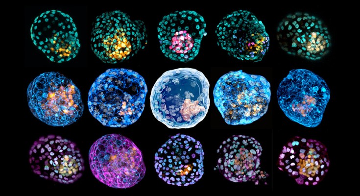 A composite image of fifteen images of iBlastoids with different cellular staining