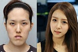 The Destructive Effects of South Korea’s Beauty Standards