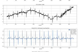 DeepFilter: An ECG baseline wander removal filter using deep learning techniques