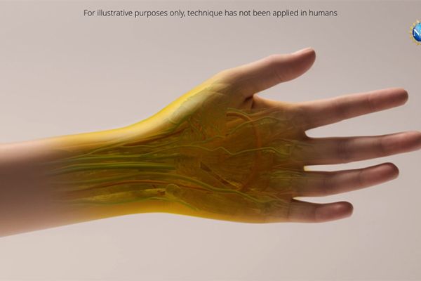 Illustration of a human hand as it might appear if the new tissue transparency effect proves effective in humans. Currently, the effect has only been tested with animals in a laboratory setting. Note that dyes may be harmful. Always exercise caution with dyes and do not consume directly, apply to people or animals, or otherwise misuse.