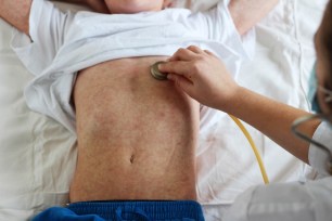 Child with measles