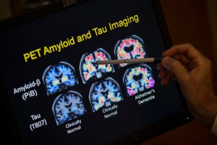 Brain scans