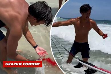 Surfer calmly walks away from ‘gnarly’ shark bite