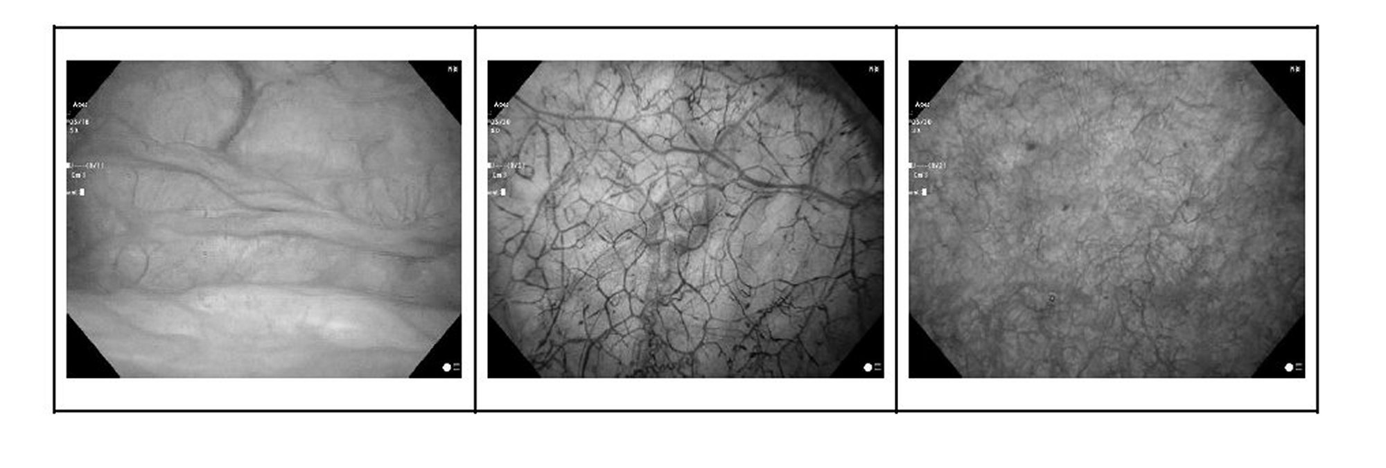 Figure 0007124041000015