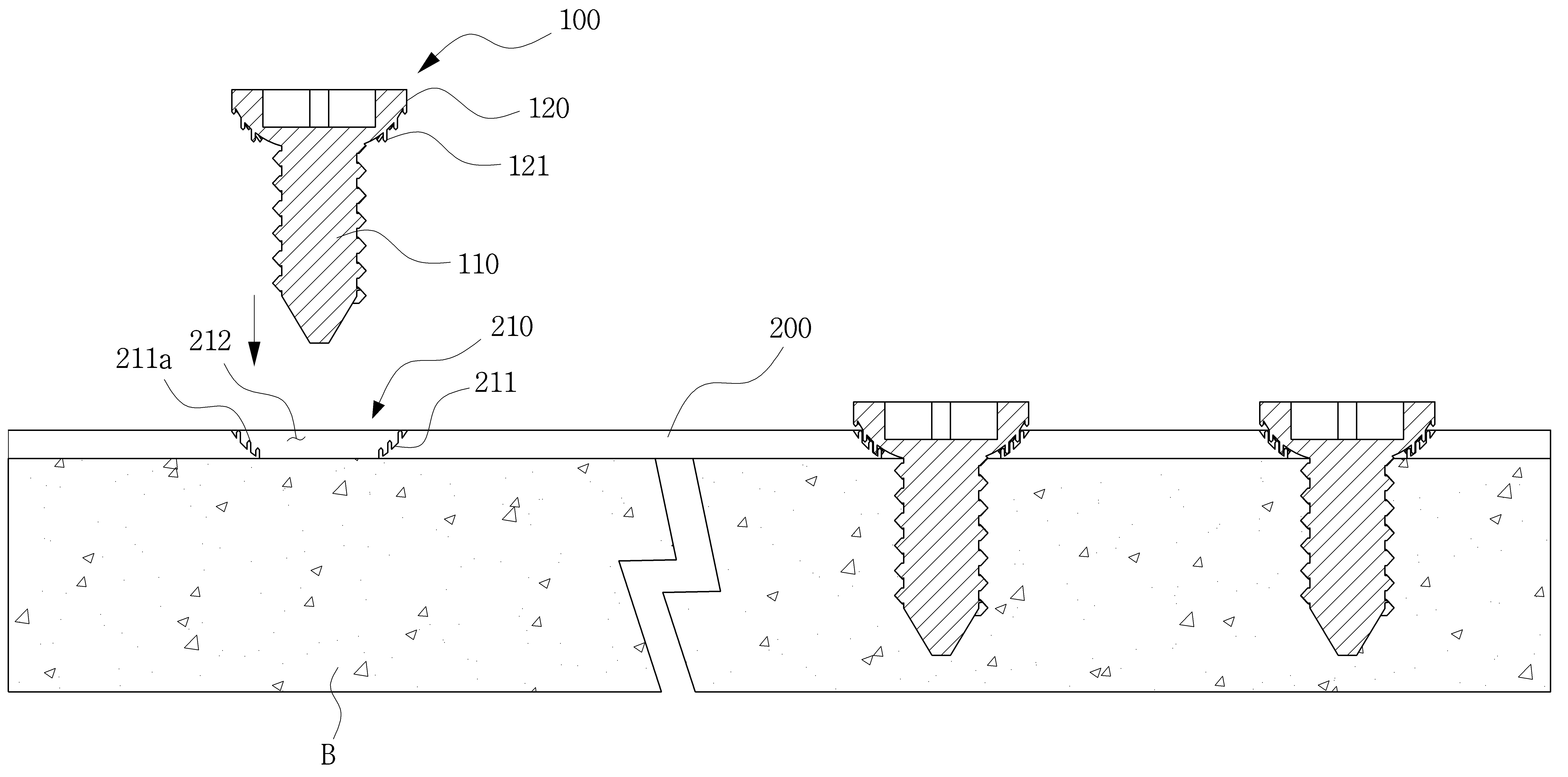 Figure R1020180047760