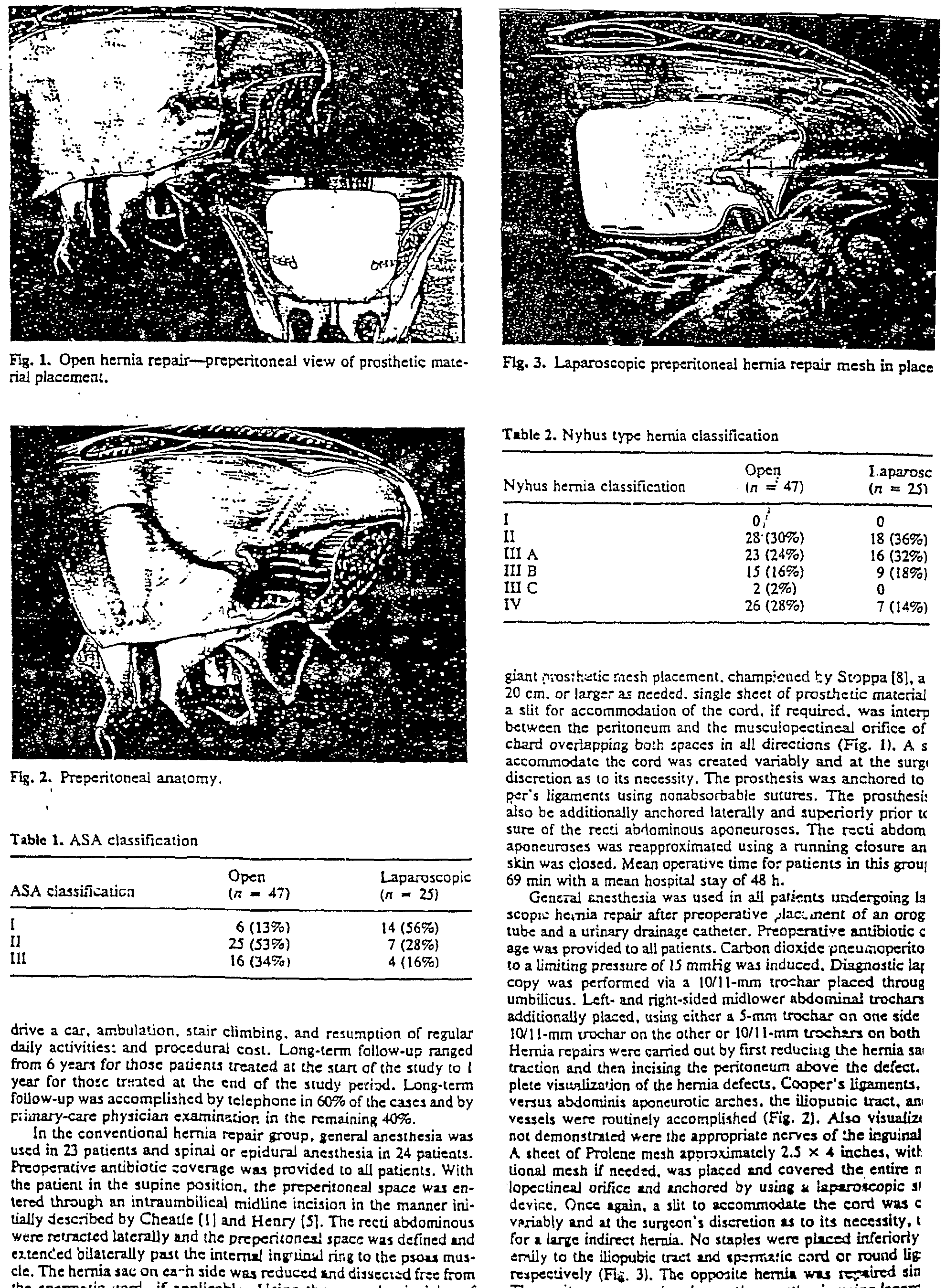 Figure imgf000017_0001