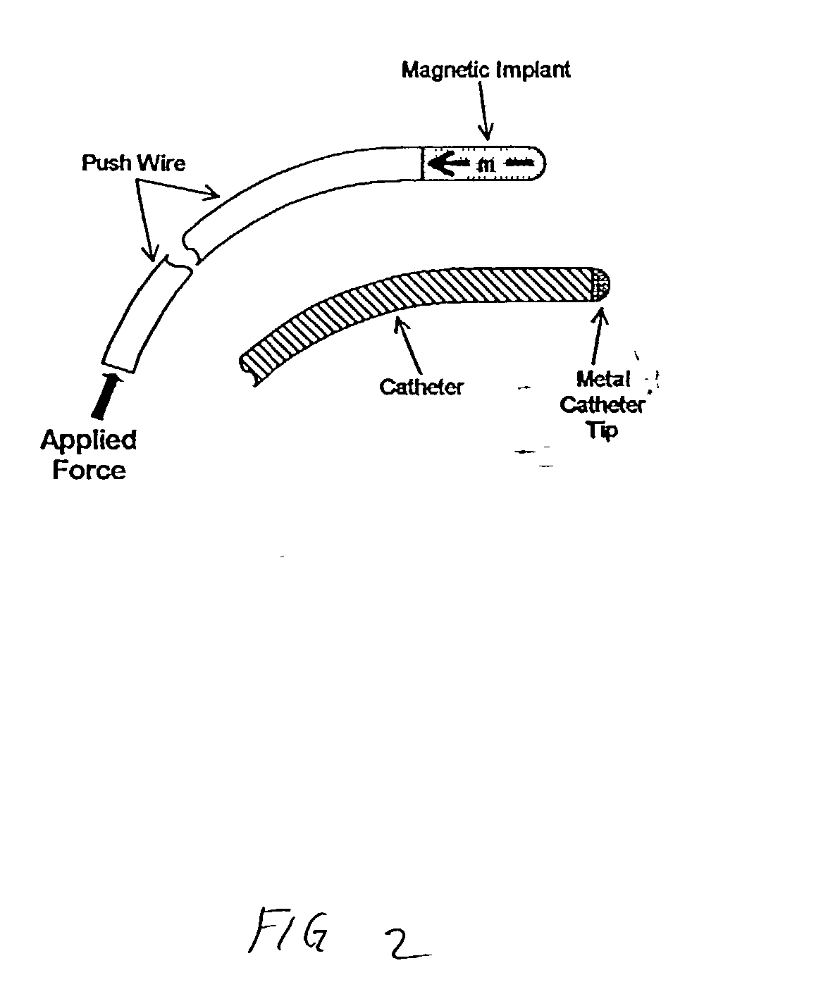 Figure US20030125752A1-20030703-P00115