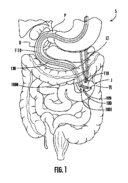 Figure 2025504065000001