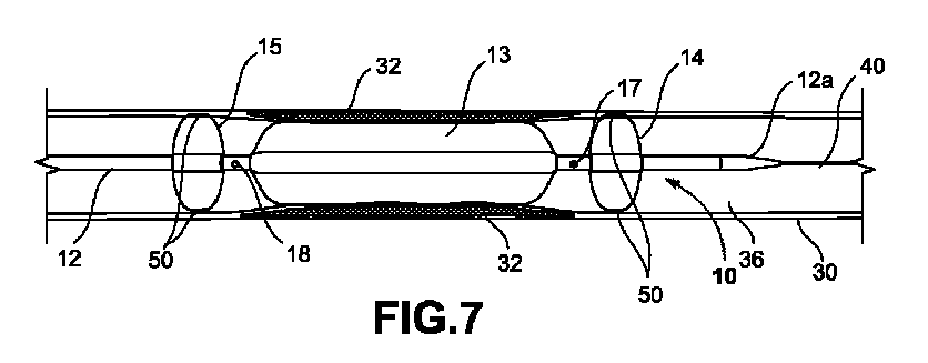 Figure 2024503651000001