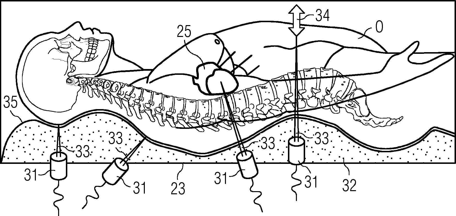 Figure DE102014201585A1_0001