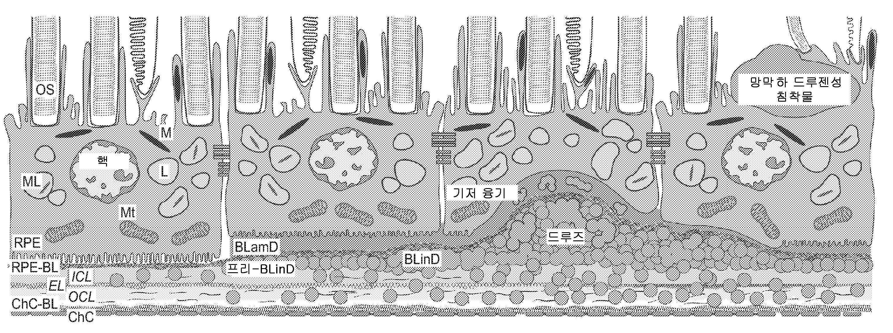 Figure P1020197021355