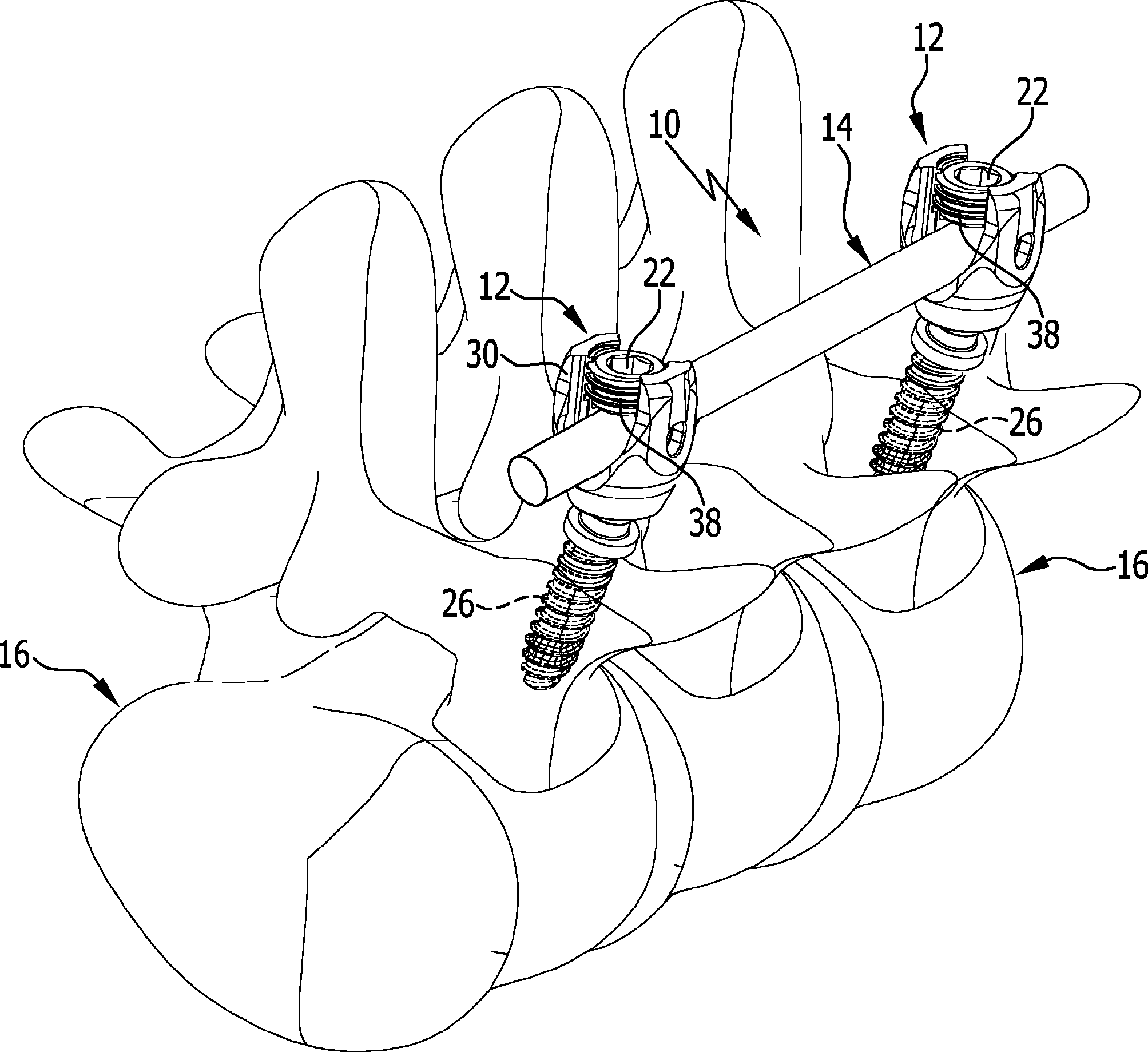 Figure DE102014117176A1_0001