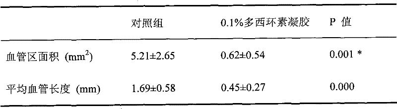 Figure G2009100384299D00112