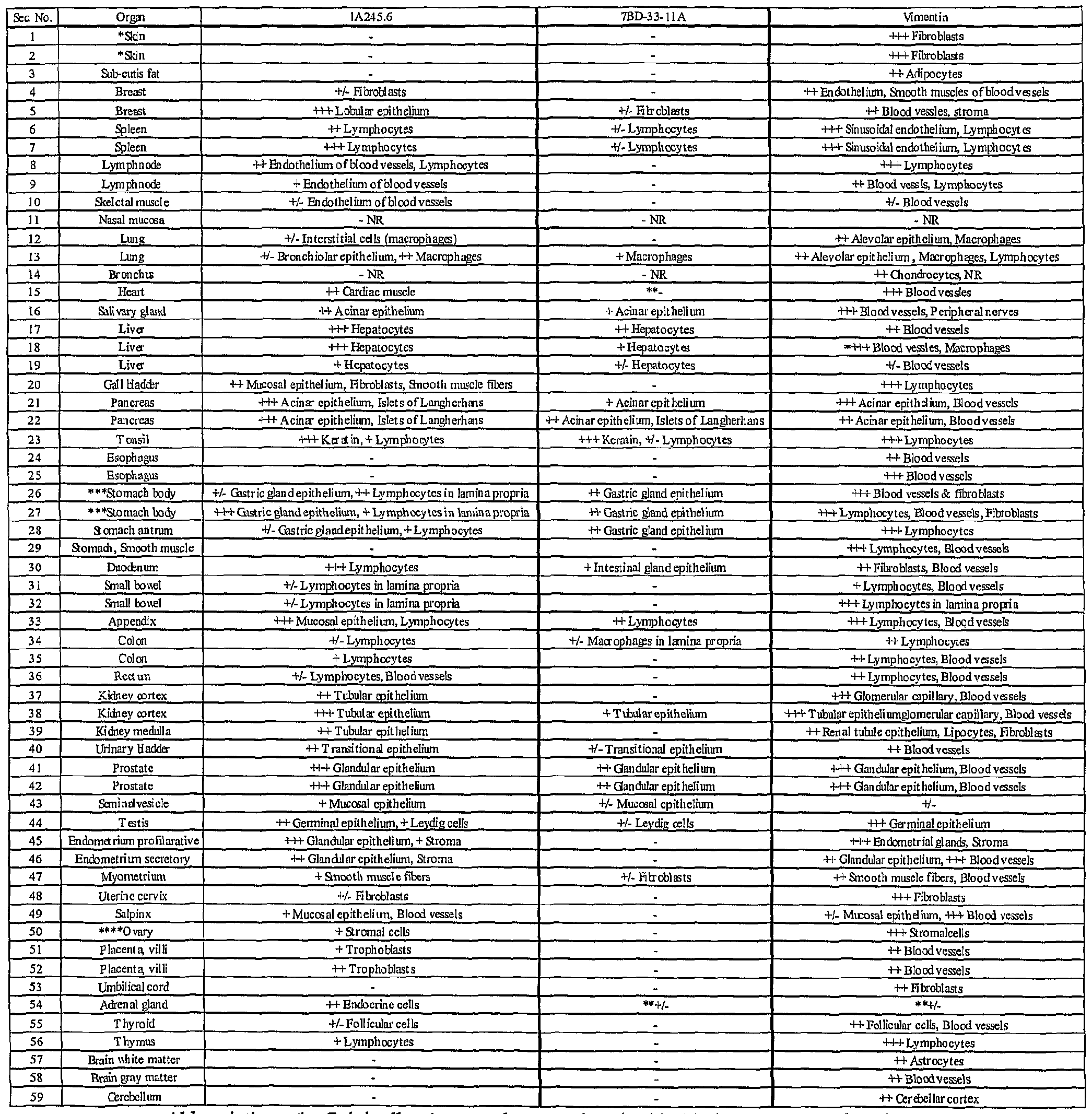 Figure imgf000036_0001