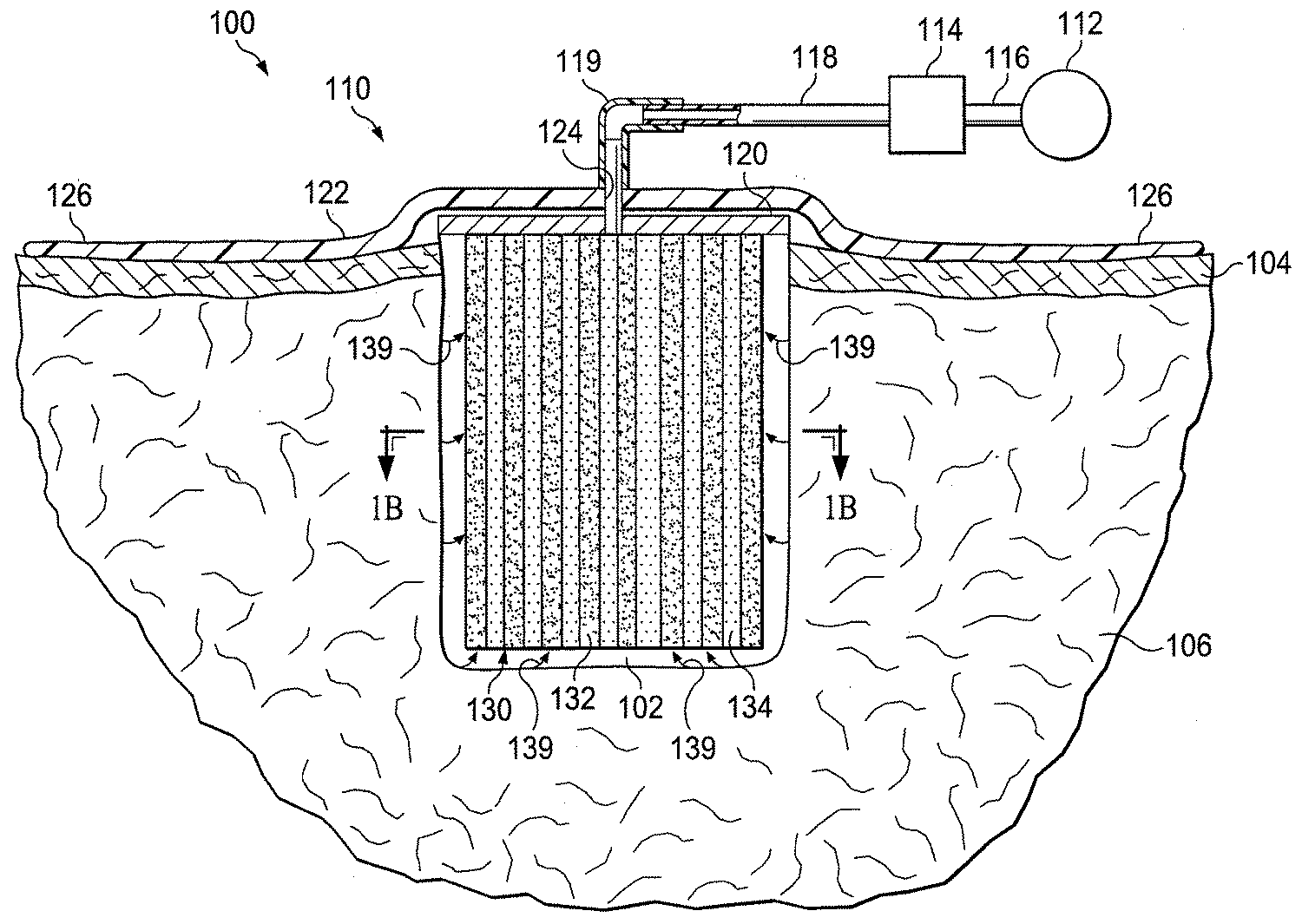 Figure P1020117017762