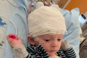 Baby Has Half His Brain Removed Due to Rare Disorder, Seizures Jackson Williamson 