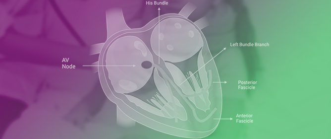 Prevalence and Clinical Significance of Intraventricular Conduction Disturbances in Hospitalized Children