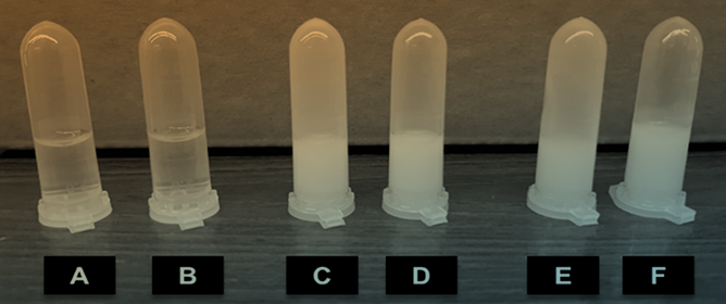 Rheological and Injectability Evaluation of Sterilized Poloxamer-407-Based Hydrogels Containing Docetaxel-Loaded Lipid Nanoparticles