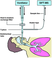 Graphical abstract: On-line, real time monitoring of exhaled trace gases by SIFT-MS in the perioperative setting: a feasibility study