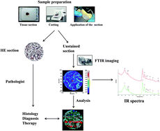 Graphical abstract: Fourier transform infrared imaging analysis in discrimination studies of bladder cancer