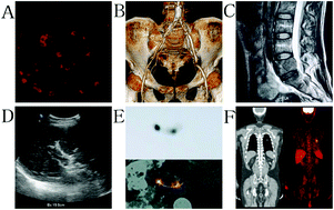 Graphical abstract: Applications of nanoparticles in biomedical imaging