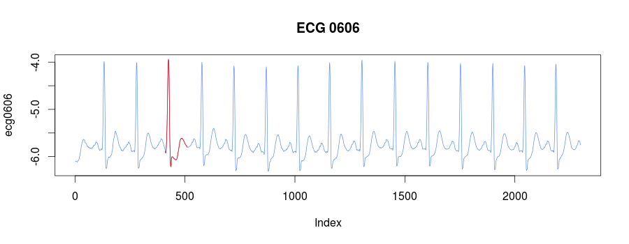 ECG0606 clusters