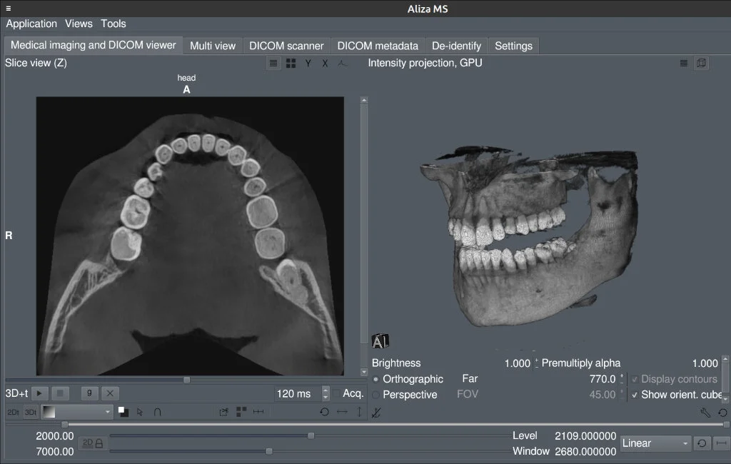 Screenshot of a user interface showing a 2D view and a 3D view of my scan.