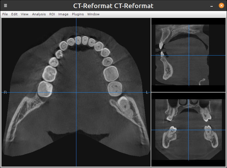 Screenshot of a user interface with three panels, each showing a different view of my teeth.