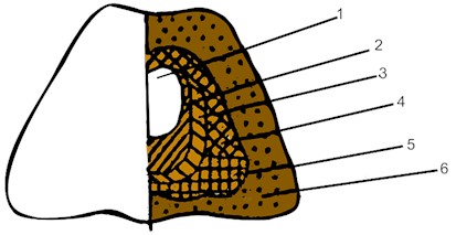 a) The structure of fused: 1 – central zone; 2 – peripheral zone; 3 – zone of single crystals;  4 – side crust; 5 – lower crust; 6 – scree (undermelted) and b) fused cast refractory materials:  1 – shrink shell; 2 – moss zone; 3 – porous zone; 4 – dense zone