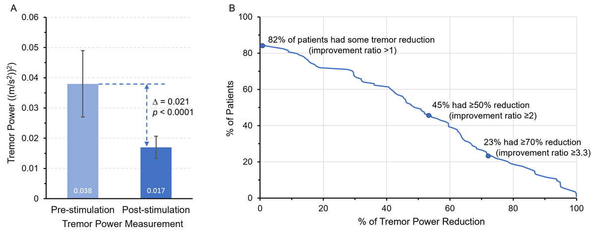 A Pragmatic Clinical Trial of Transcutaneous Afferent Patterned Stimulation in Essential Tremor