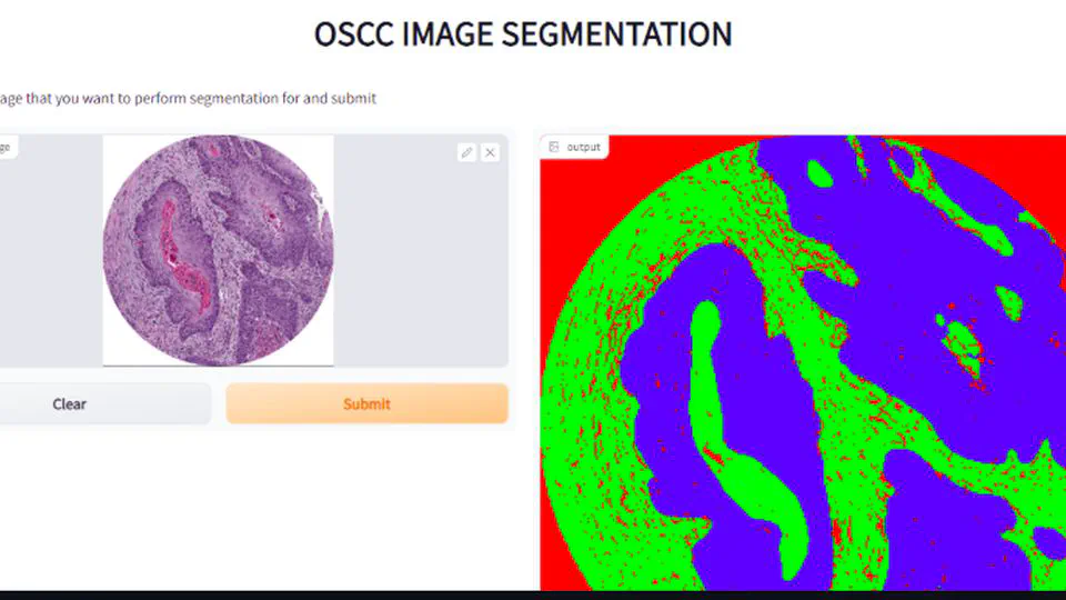 Experimental Comparison of State-of-the-Art Deep Learning Approaches for Oral Squamous Cell Carcinoma Cancer Segmentation