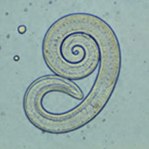 File:Trichinella larv1 DPDx.JPG