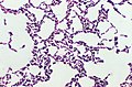 Bacillus coagulans